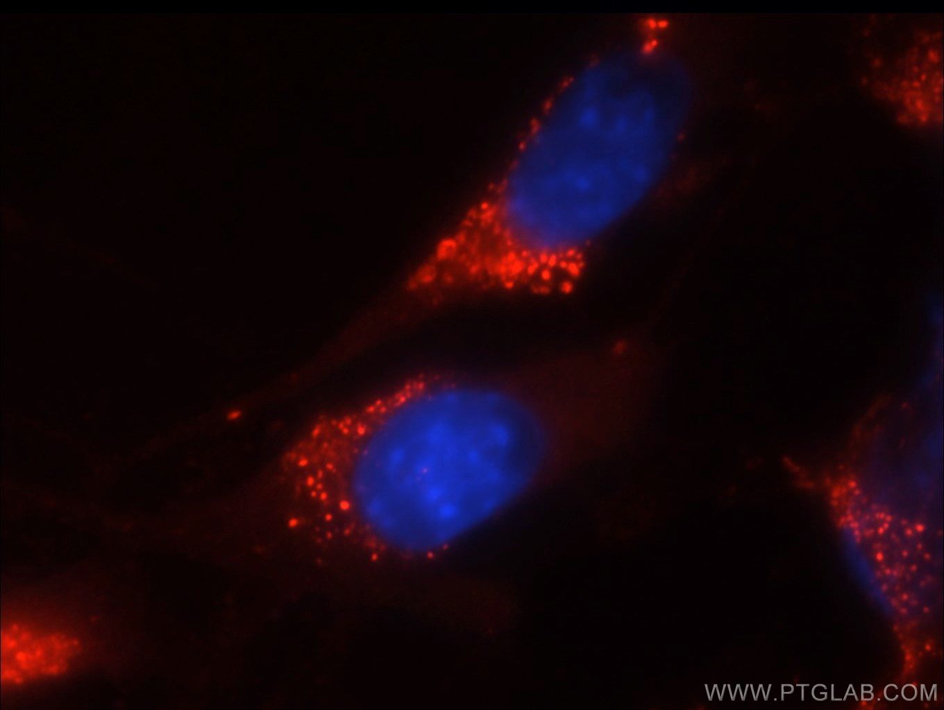 Immunofluorescence (IF) / fluorescent staining of NIH/3T3 cells using CD38 Monoclonal antibody (60006-1-Ig)
