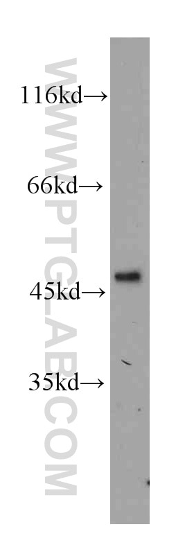 Western Blot (WB) analysis of Raji cells using CD38 Monoclonal antibody (60006-1-Ig)