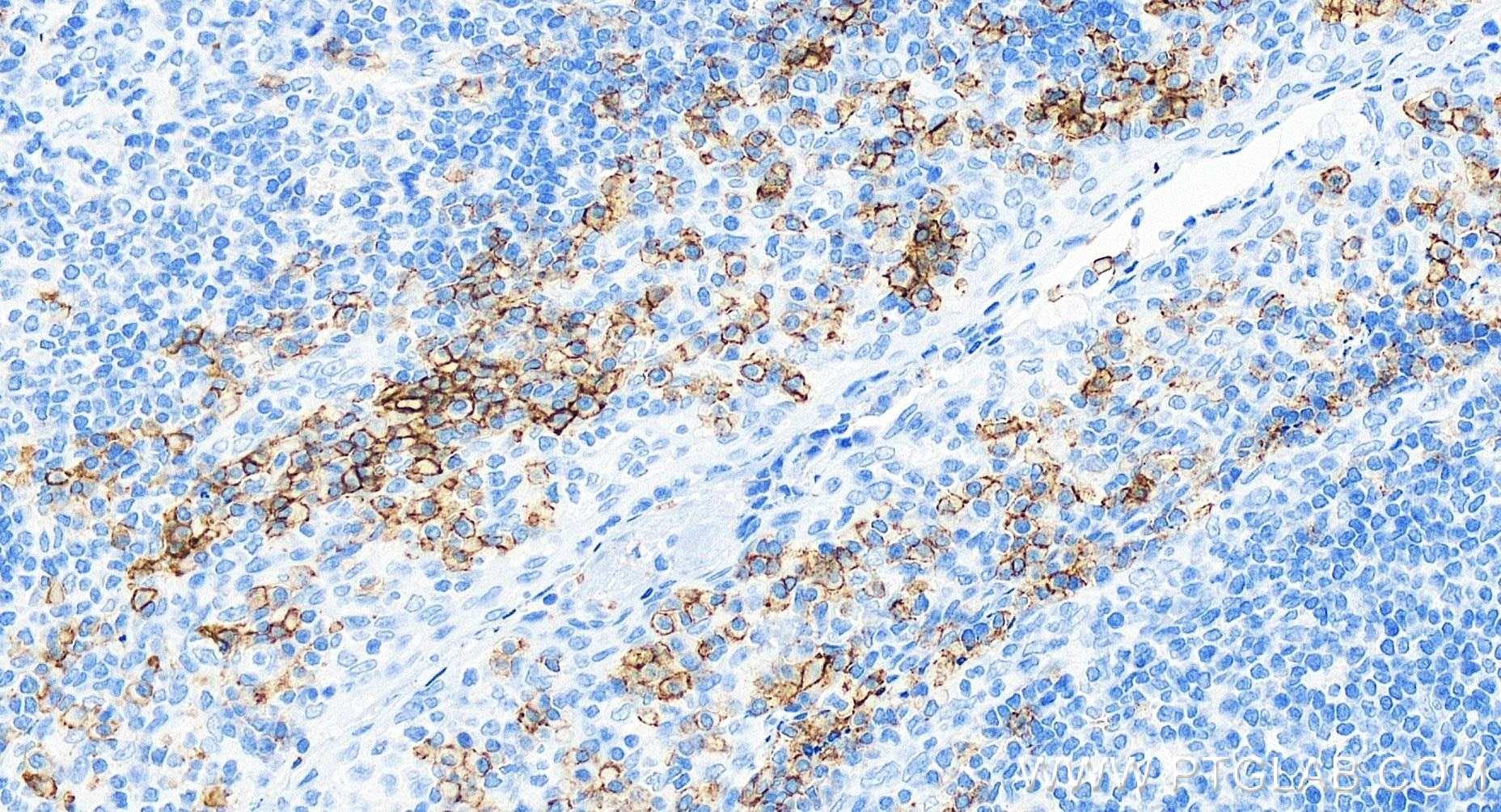 CD38