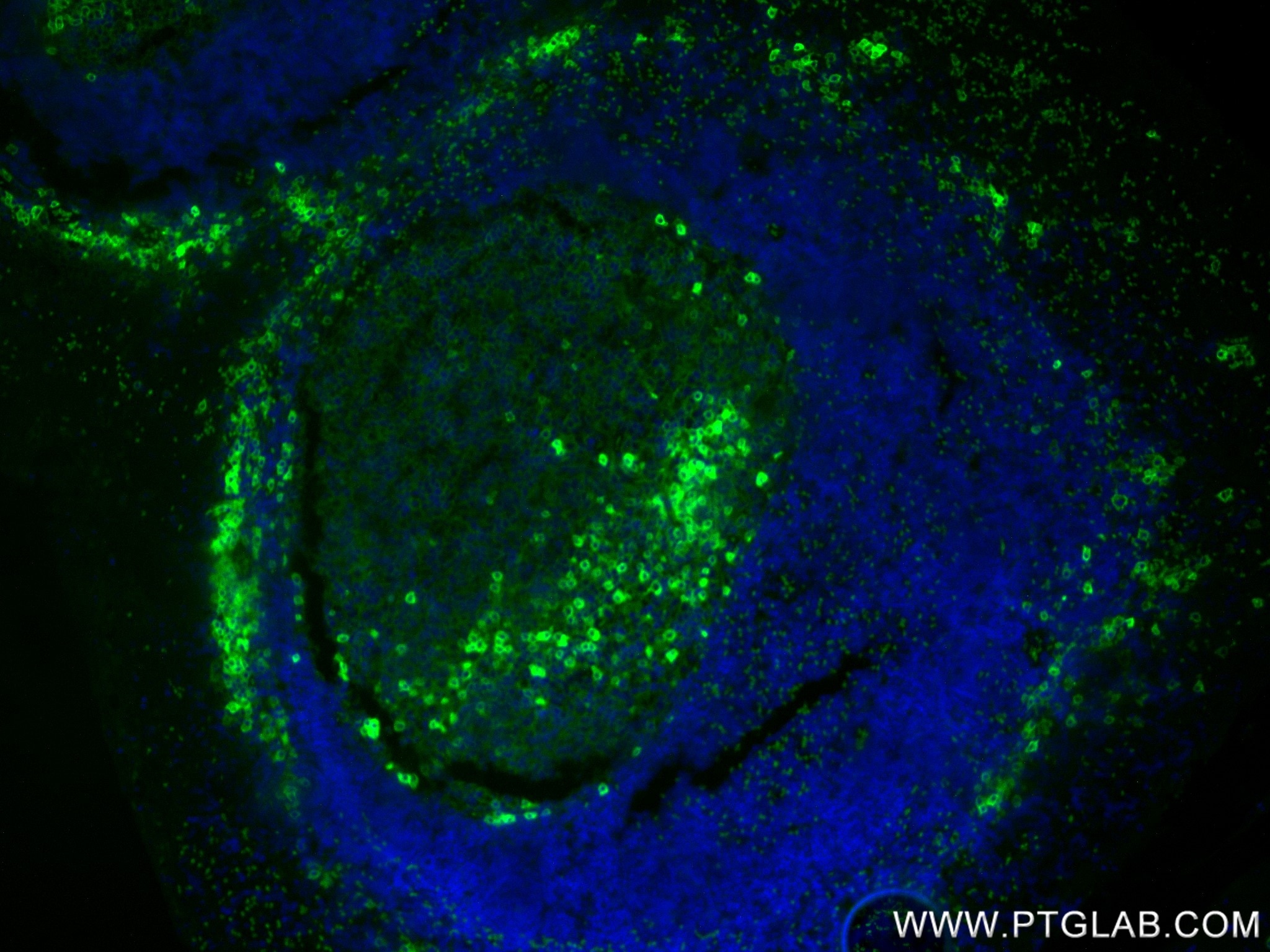Immunofluorescence (IF) / fluorescent staining of human tonsillitis tissue using CD38 Recombinant monoclonal antibody (84070-6-RR)