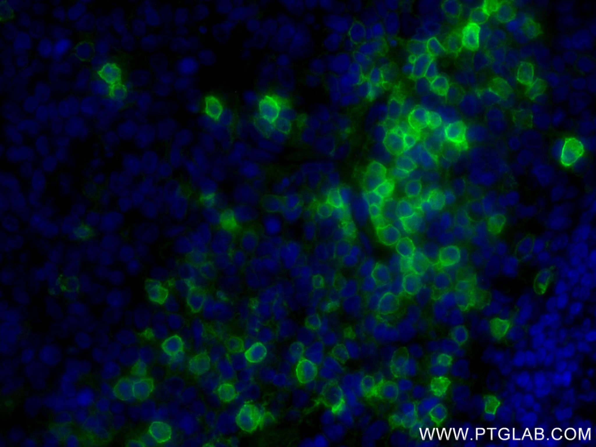 Immunofluorescence (IF) / fluorescent staining of human tonsillitis tissue using CD38 Recombinant monoclonal antibody (84070-6-RR)