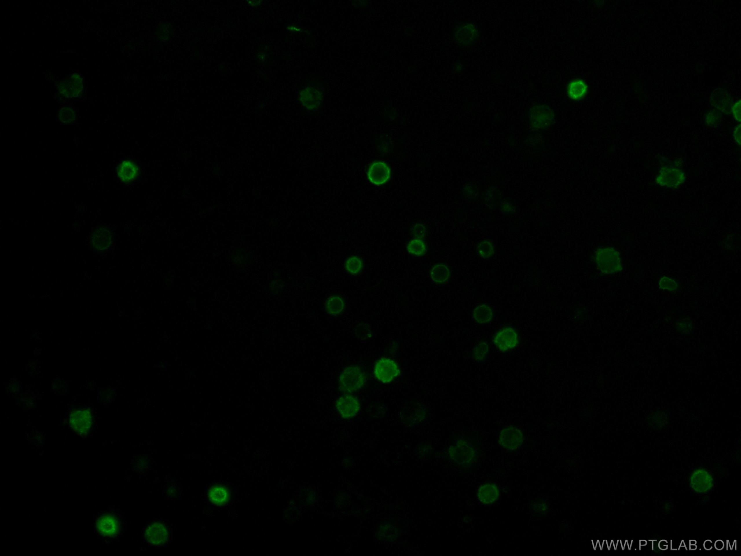 Immunofluorescence (IF) / fluorescent staining of human peripheral blood mononuclear cells using CoraLite®488 Anti-Human CD38 (HB7) (CL488-65107)
