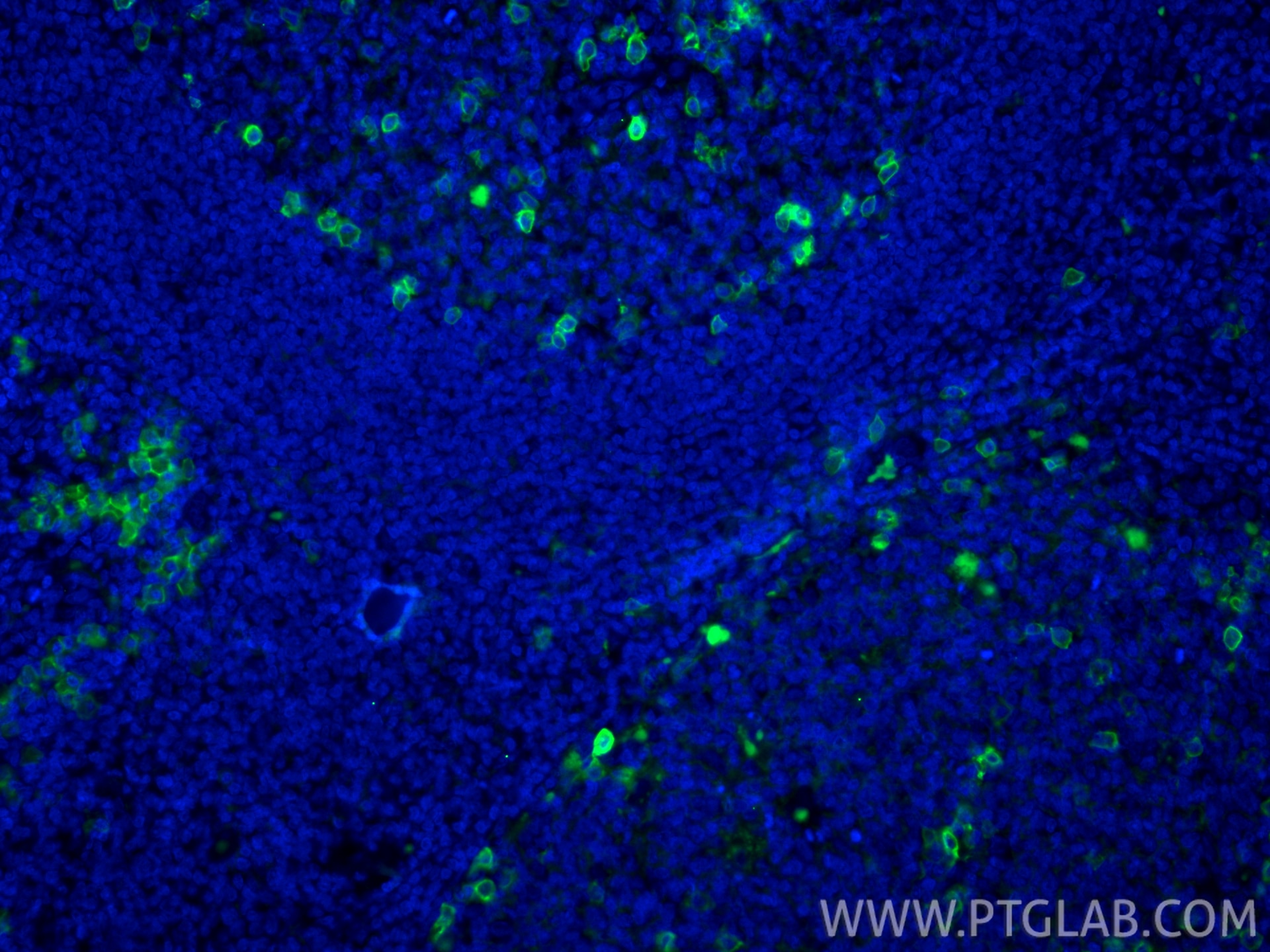 Immunofluorescence (IF) / fluorescent staining of human tonsillitis tissue using CoraLite® Plus 488-conjugated CD38 Recombinant mon (CL488-84070-6)