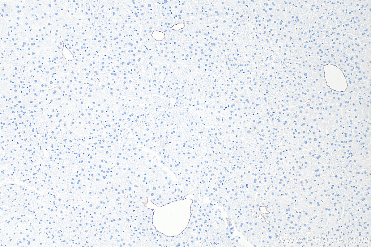 IHC staining of mouse liver using 86327-1-RR (same clone as 86327-1-PBS) Immunohistochemistry (IHC) staining of mouse liver tissue using CD39/ENTPD1 Recombinant monoclonal antibody (86327-1-RR)