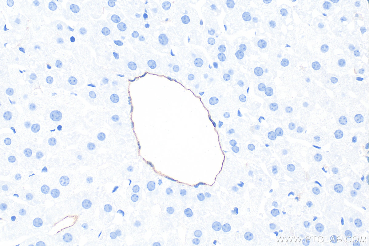 IHC staining of mouse liver using 86327-1-RR Immunohistochemistry (IHC) staining of mouse liver tissue using CD39/ENTPD1 Recombinant monoclonal antibody (86327-1-RR)
