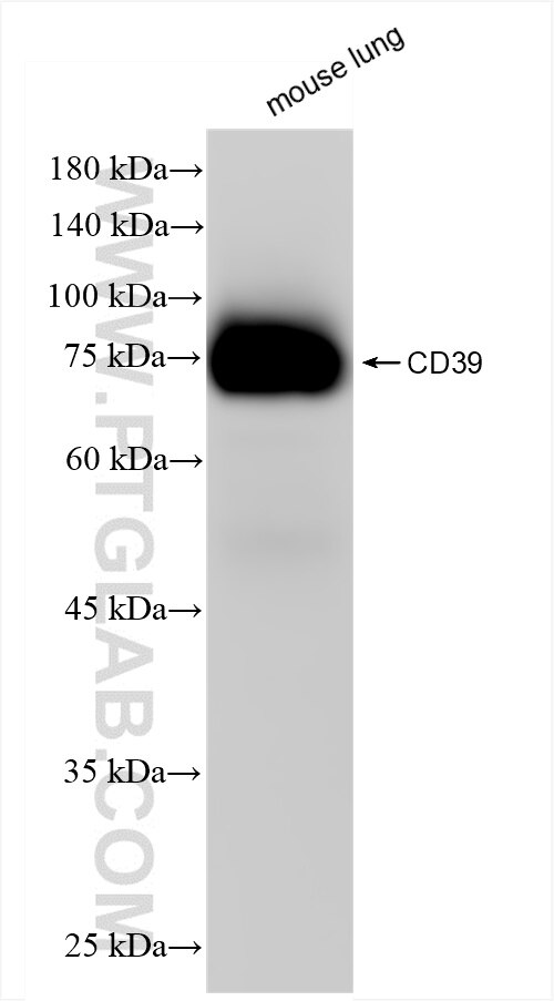 Western Blot (WB) analysis of mouse lung tissue using CD39/ENTPD1 Recombinant antibody (86327-1-RR)