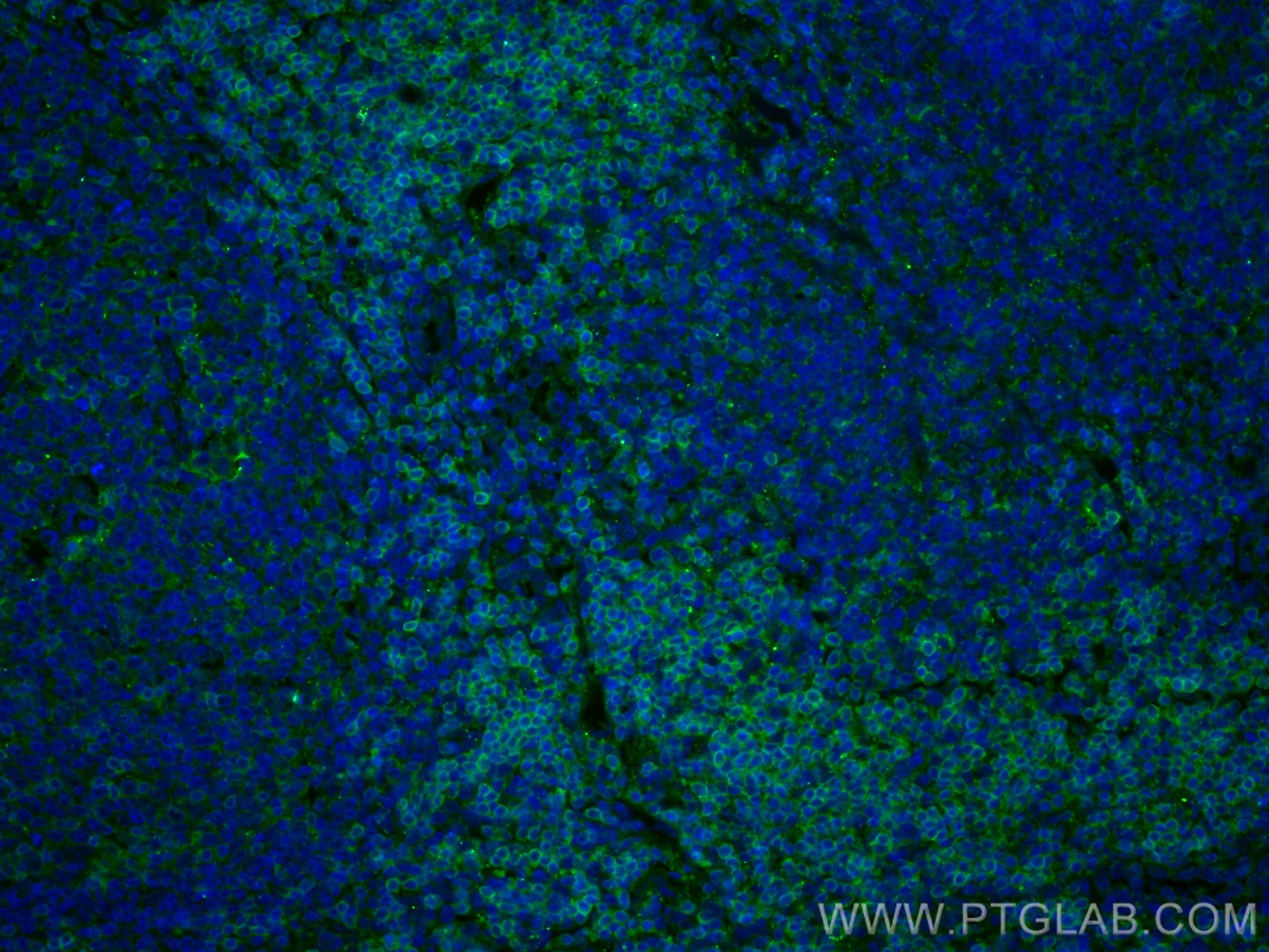 Immunofluorescence (IF) / fluorescent staining of human tonsillitis tissue using CD3 Delta Polyclonal antibody (16669-1-AP)