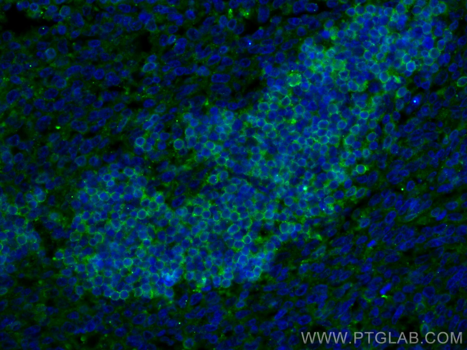 Immunofluorescence (IF) / fluorescent staining of human tonsillitis tissue using CD3 Delta Polyclonal antibody (16669-1-AP)