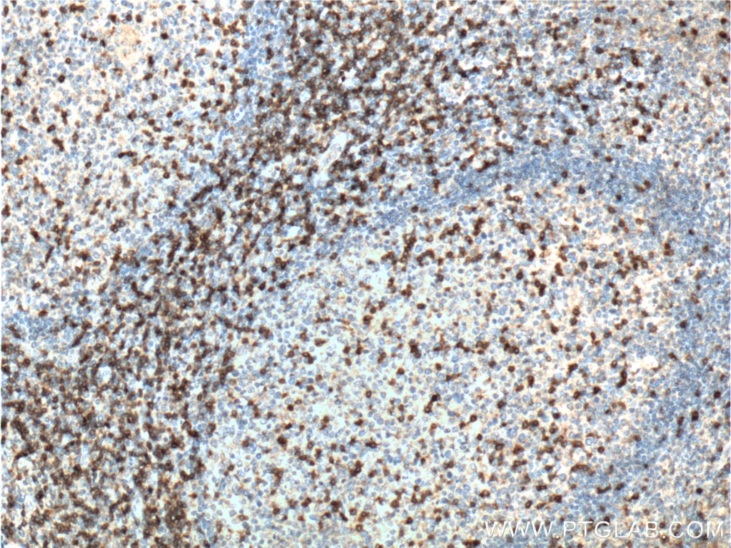 CD3 Delta Polyclonal antibody