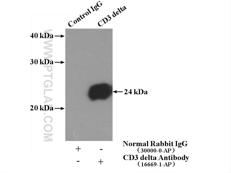 Immunoprecipitation (IP) experiment of Jurkat cells using CD3 Delta Polyclonal antibody (16669-1-AP)