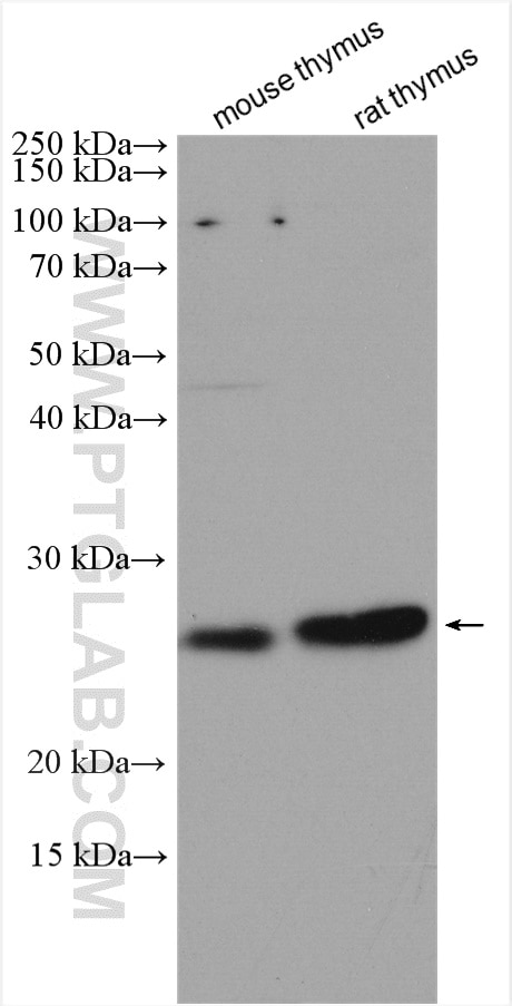 Western Blot (WB) analysis of various lysates using CD3 Delta Polyclonal antibody (16669-1-AP)