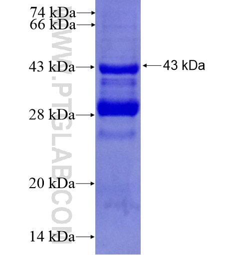 CD3D fusion protein Ag10148 SDS-PAGE