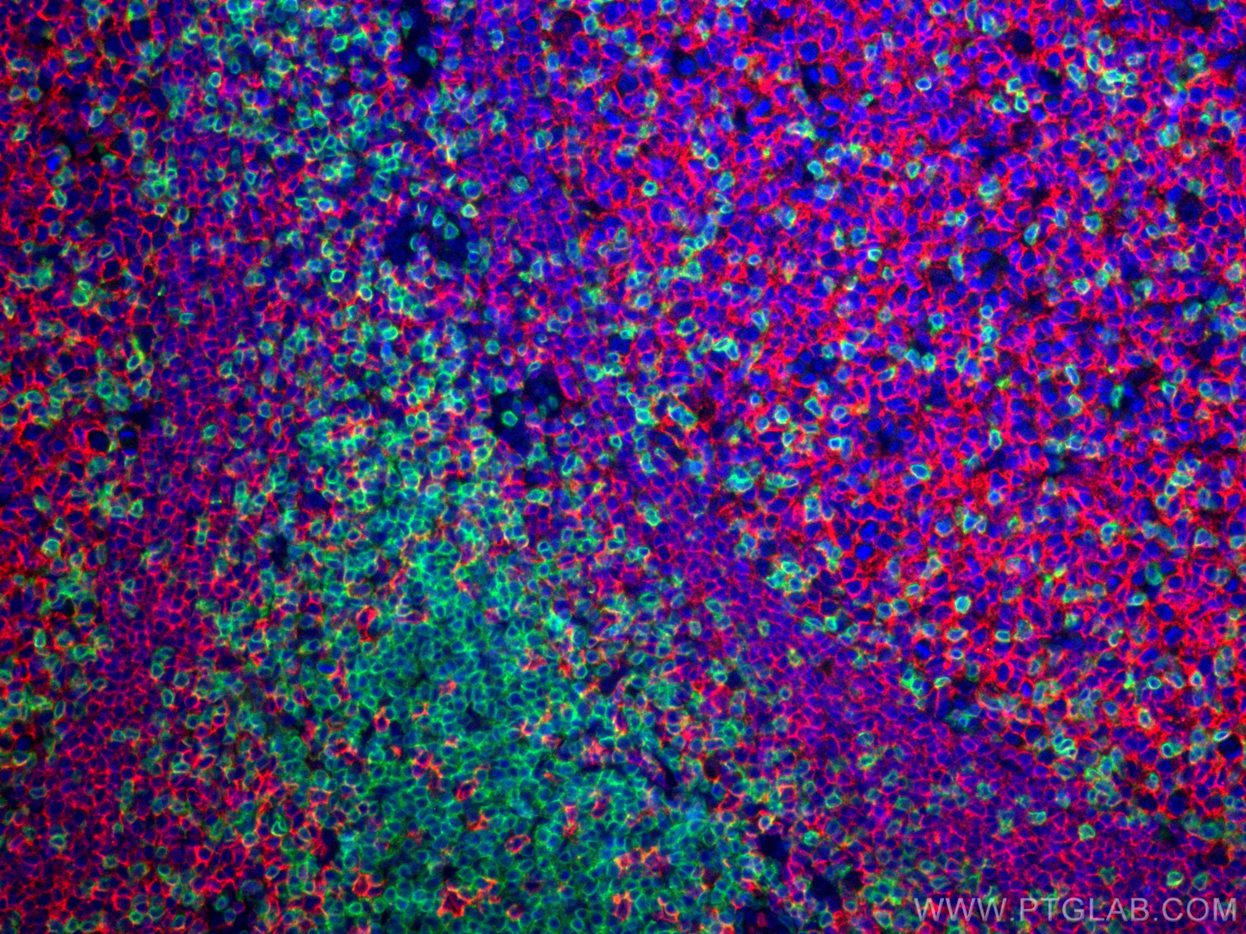 Immunofluorescence (IF) / fluorescent staining of human tonsillitis tissue using CD3 Polyclonal antibody (17617-1-AP)