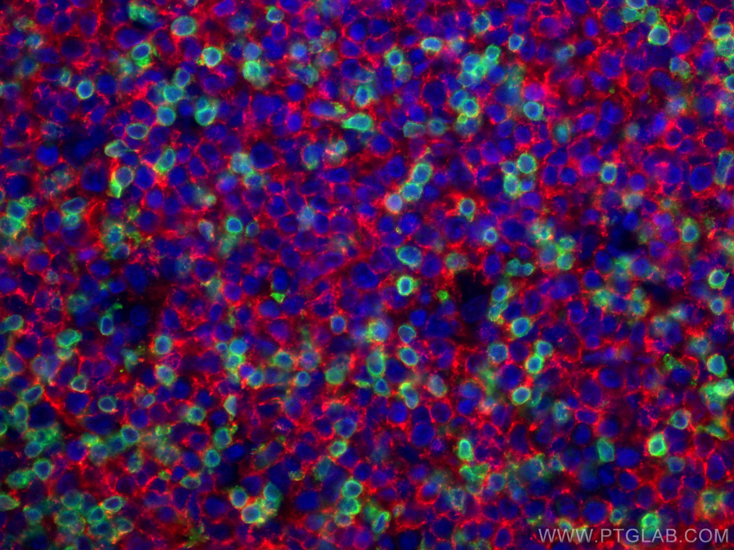 Immunofluorescence (IF) / fluorescent staining of human tonsillitis tissue using CD3 Polyclonal antibody (17617-1-AP)