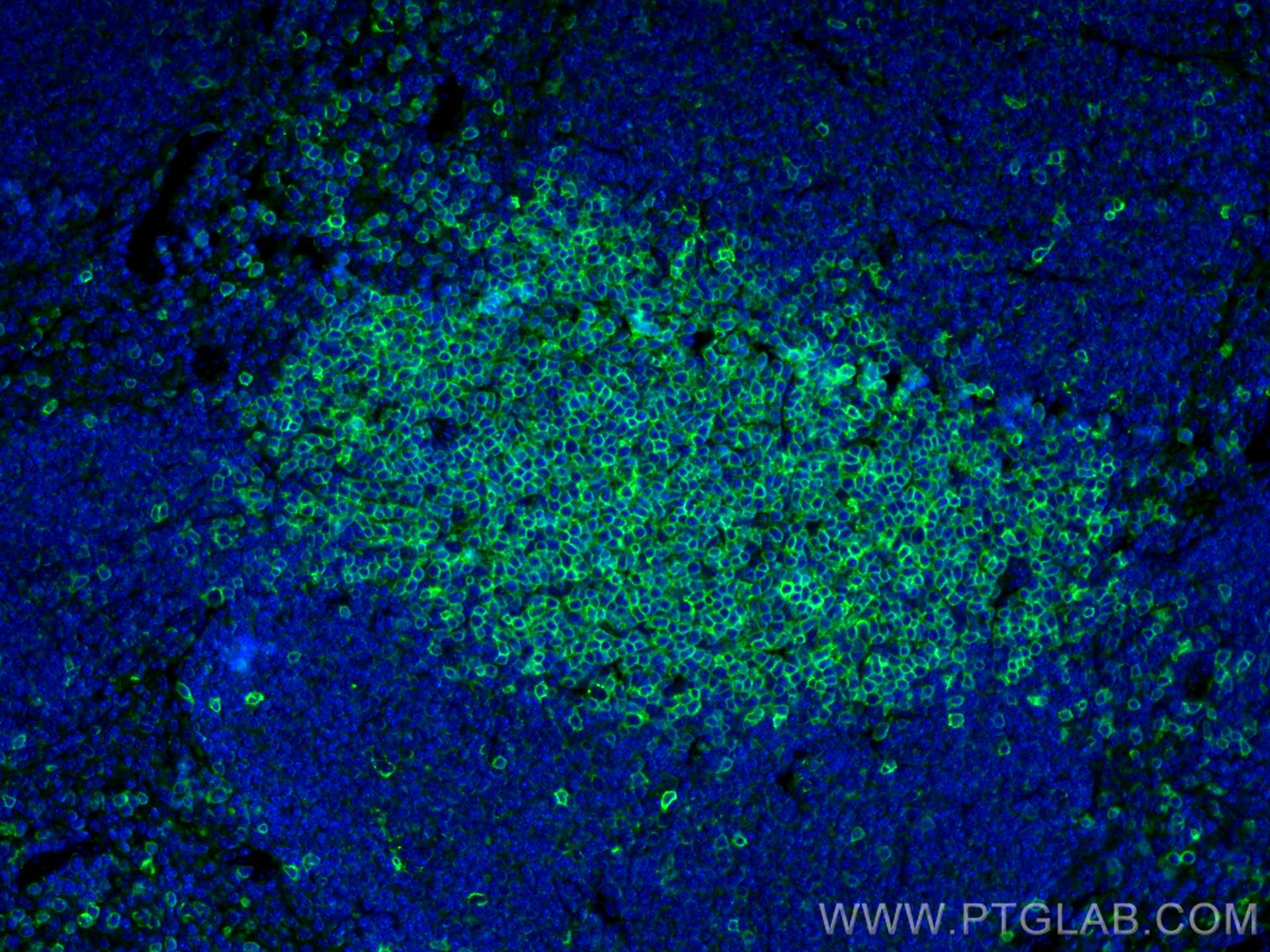Immunofluorescence (IF) / fluorescent staining of mouse spleen tissue using CD3 Polyclonal antibody (17617-1-AP)