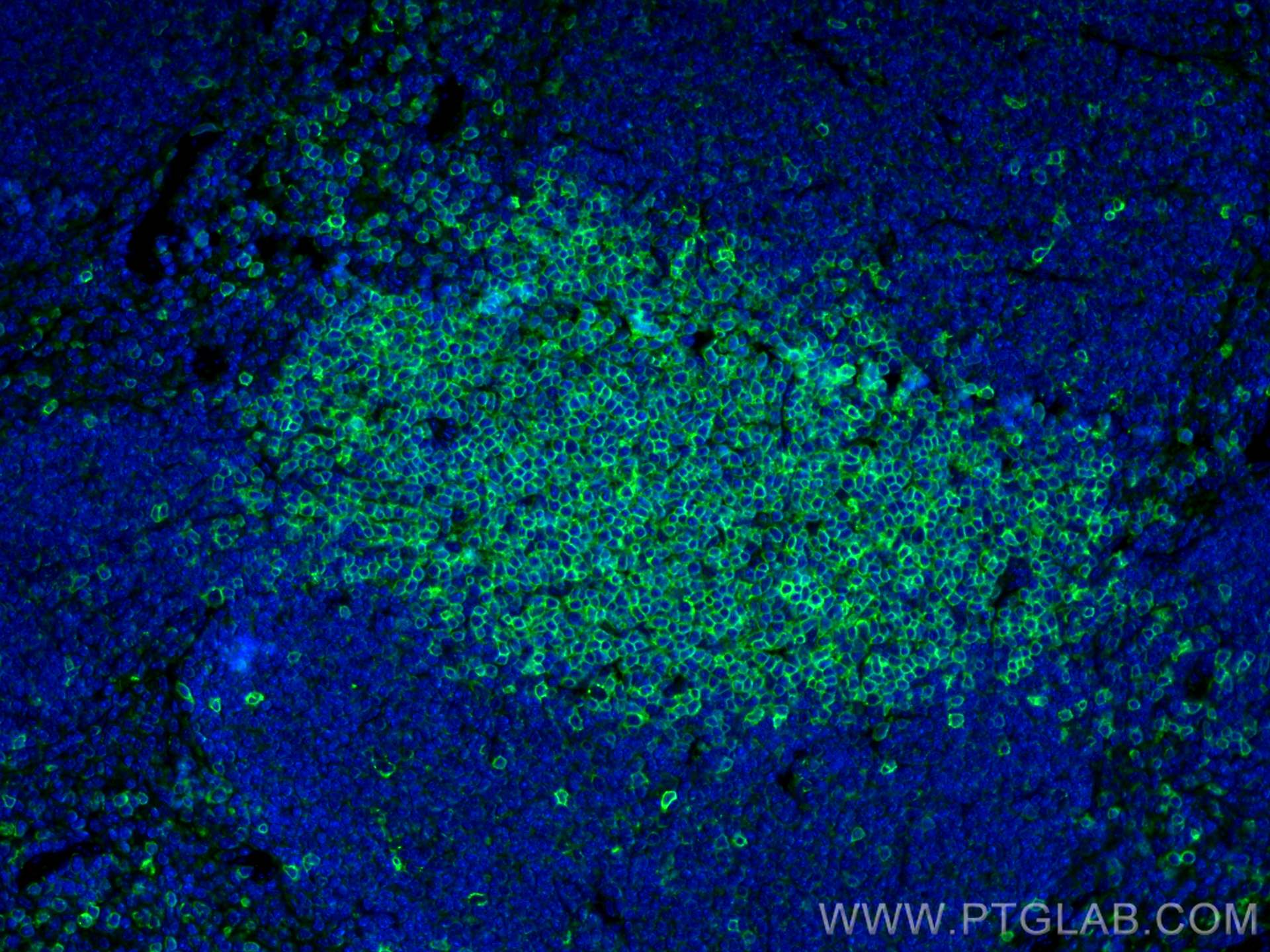 IF Staining of mouse spleen using 17617-1-AP