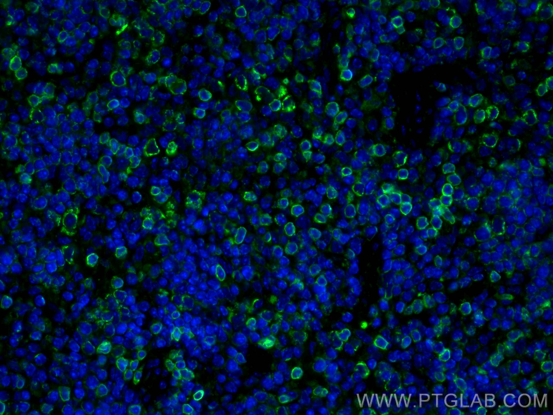 IF Staining of mouse spleen using 17617-1-AP