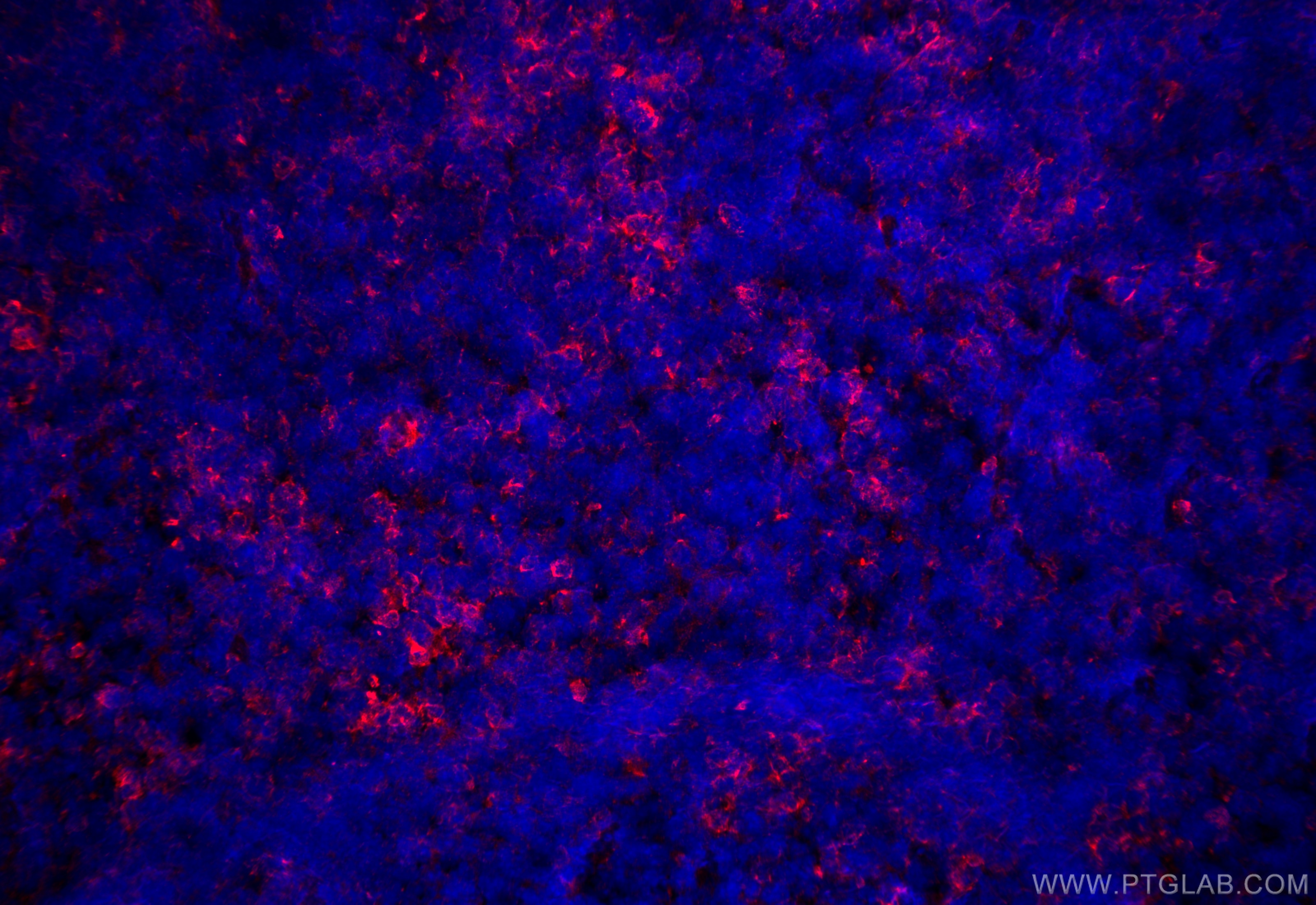 Immunofluorescence (IF) / fluorescent staining of mouse spleen tissue using CD3 Polyclonal antibody (17617-1-AP)
