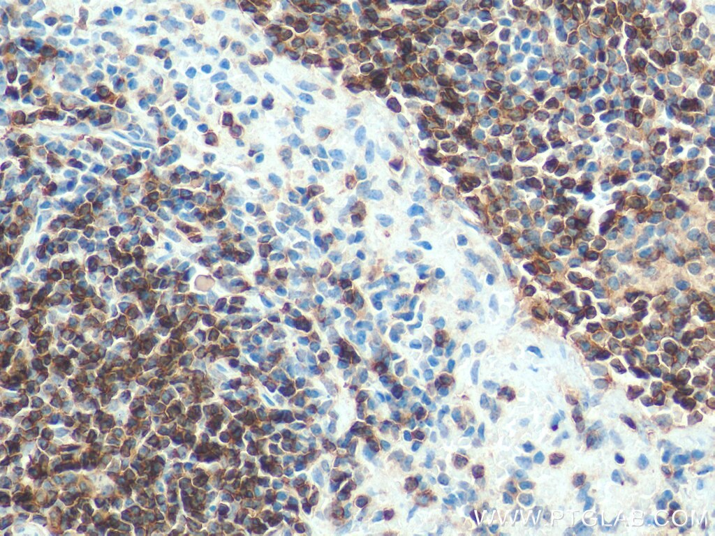 IHC staining of mouse spleen using 17617-1-AP