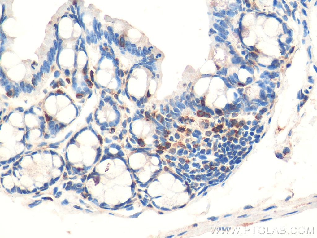 Immunohistochemistry (IHC) staining of mouse colon tissue using CD3 Polyclonal antibody (17617-1-AP)