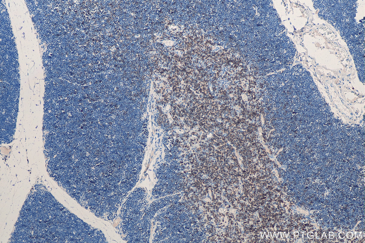 IHC staining of rat thymus using 17617-1-AP