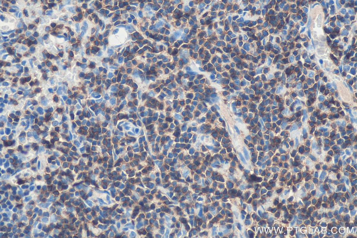 Immunohistochemistry (IHC) staining of rat thymus tissue using CD3 Polyclonal antibody (17617-1-AP)