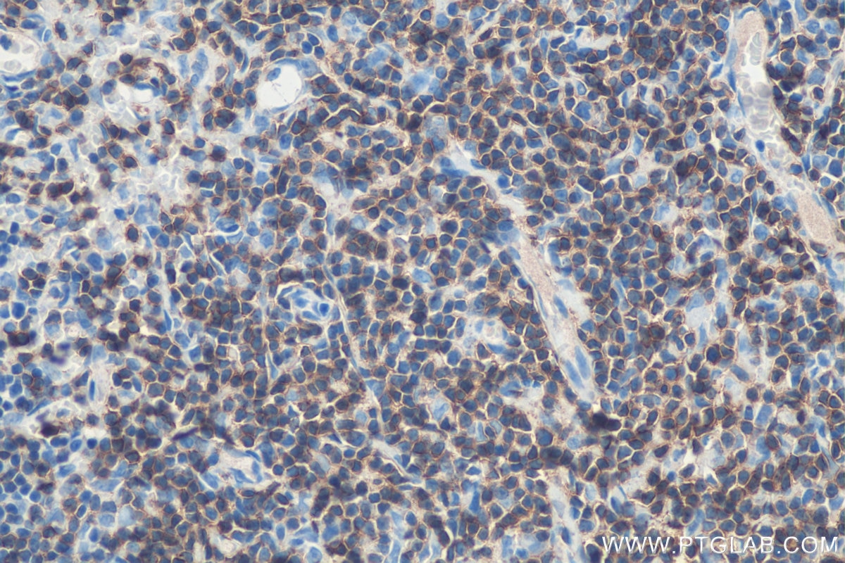 IHC staining of rat thymus using 17617-1-AP