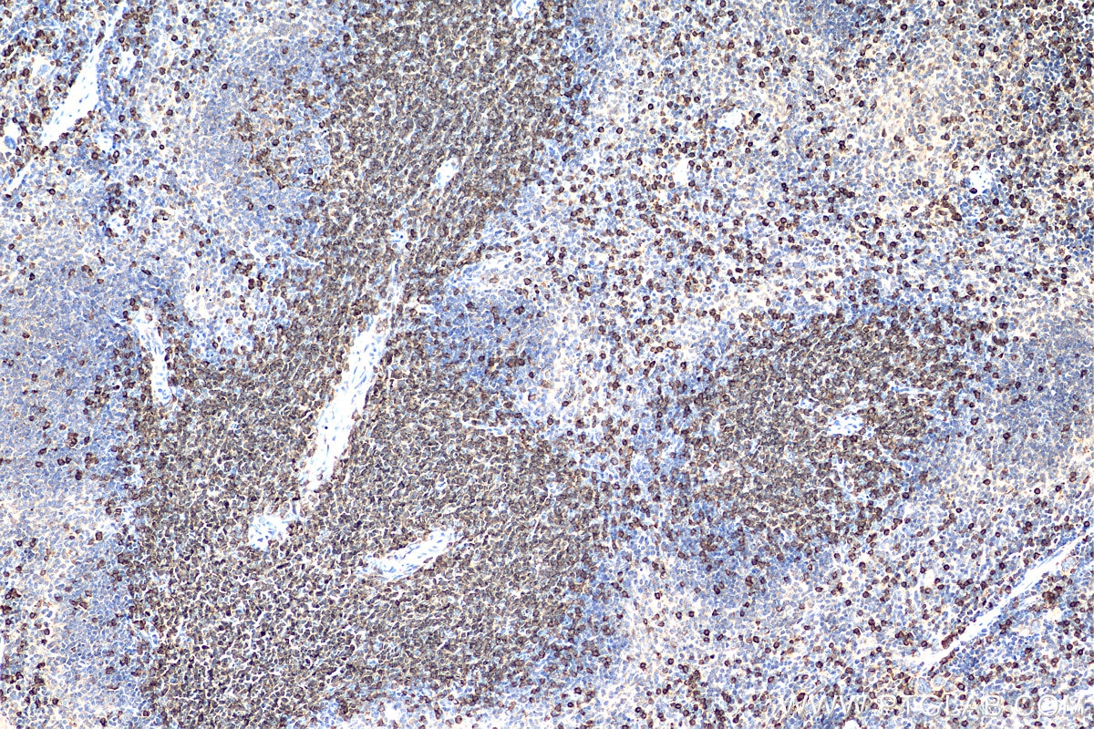 Immunohistochemistry (IHC) staining of mouse spleen tissue using CD3 Polyclonal antibody (17617-1-AP)