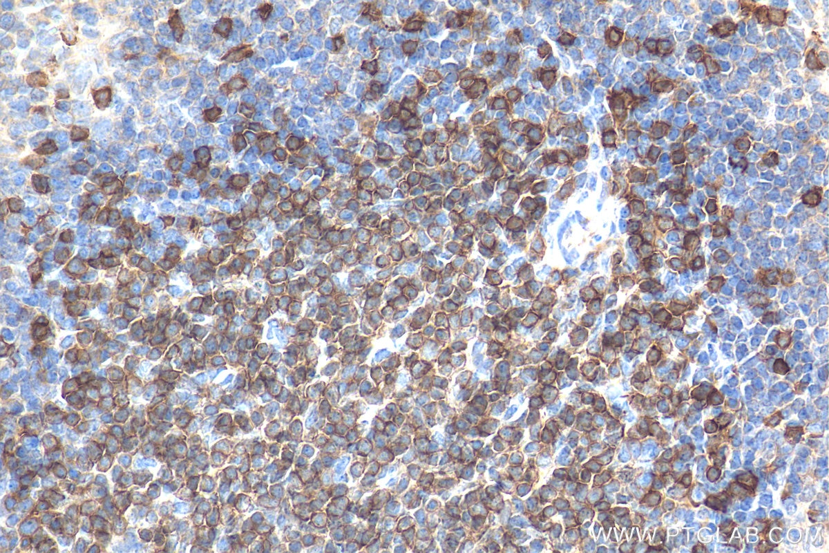 Immunohistochemistry (IHC) staining of mouse spleen tissue using CD3 Polyclonal antibody (17617-1-AP)
