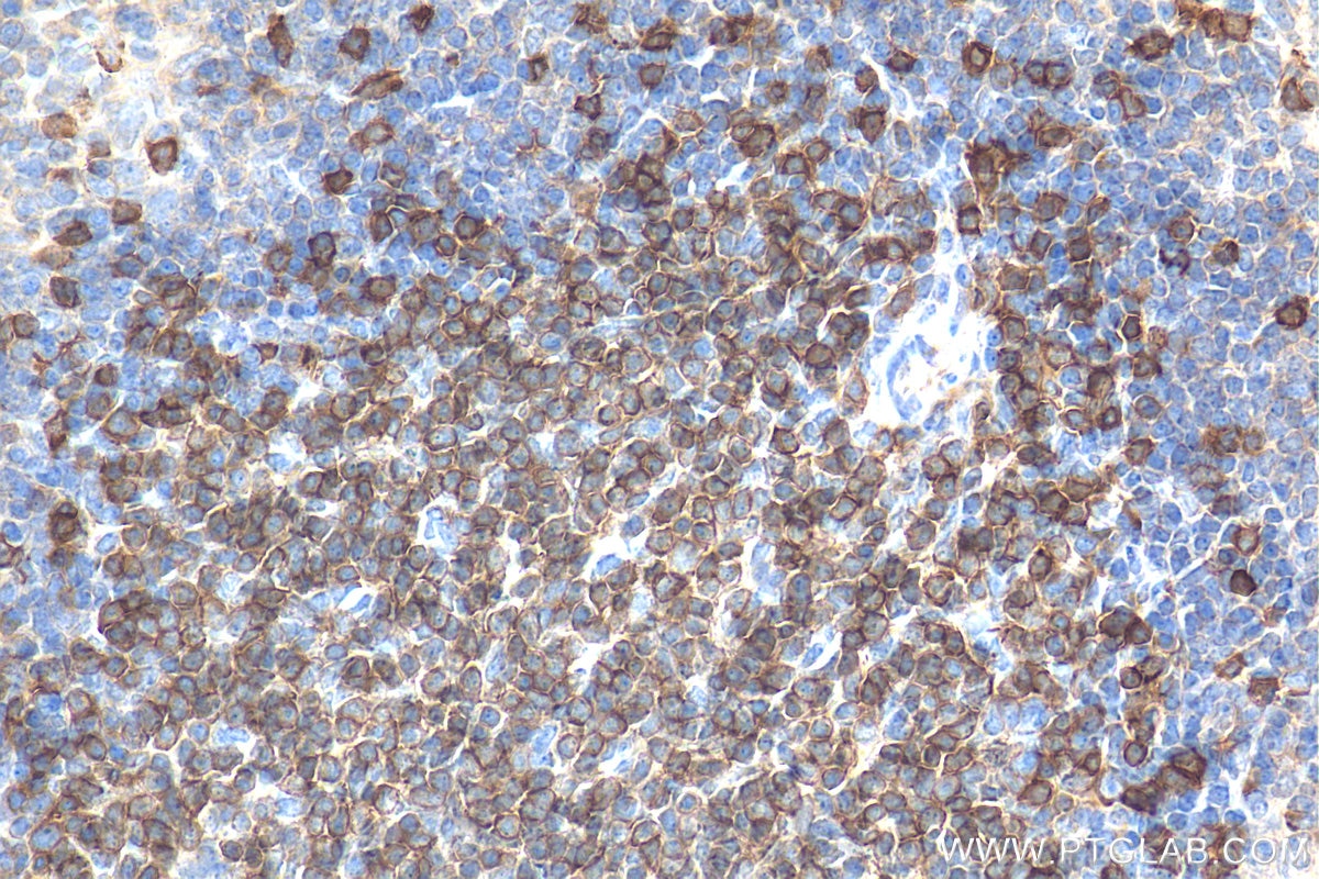 IHC staining of mouse spleen using 17617-1-AP