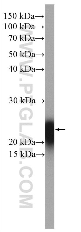Western Blot (WB) analysis of pig spleen tissue using CD3 Polyclonal antibody (17617-1-AP)