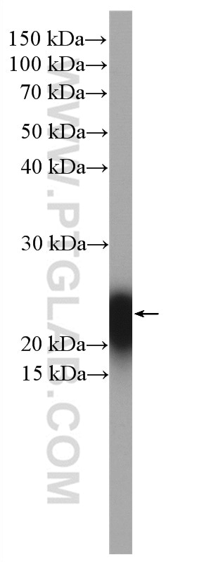 WB analysis of pig spleen using 17617-1-AP