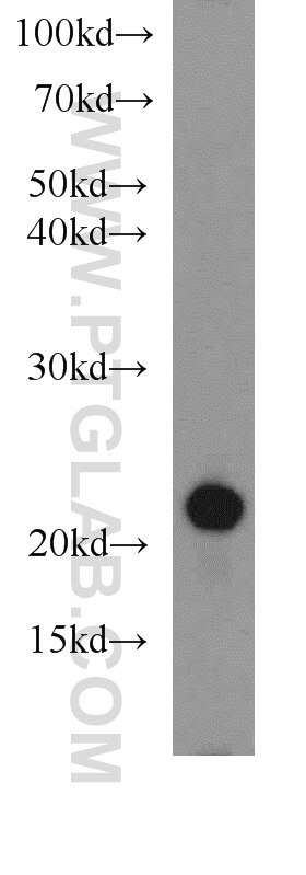 CD3 Polyclonal antibody