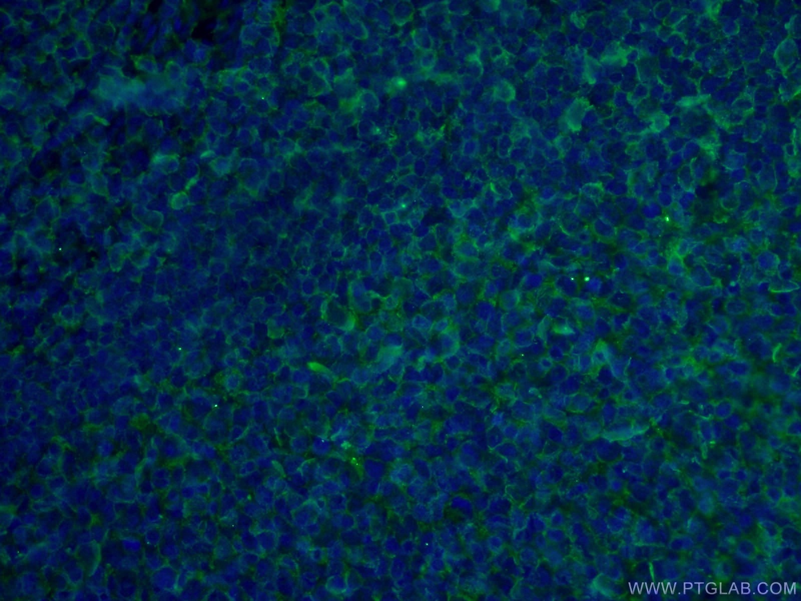 Immunofluorescence (IF) / fluorescent staining of human tonsillitis tissue using CD3 Monoclonal antibody (60181-1-Ig)