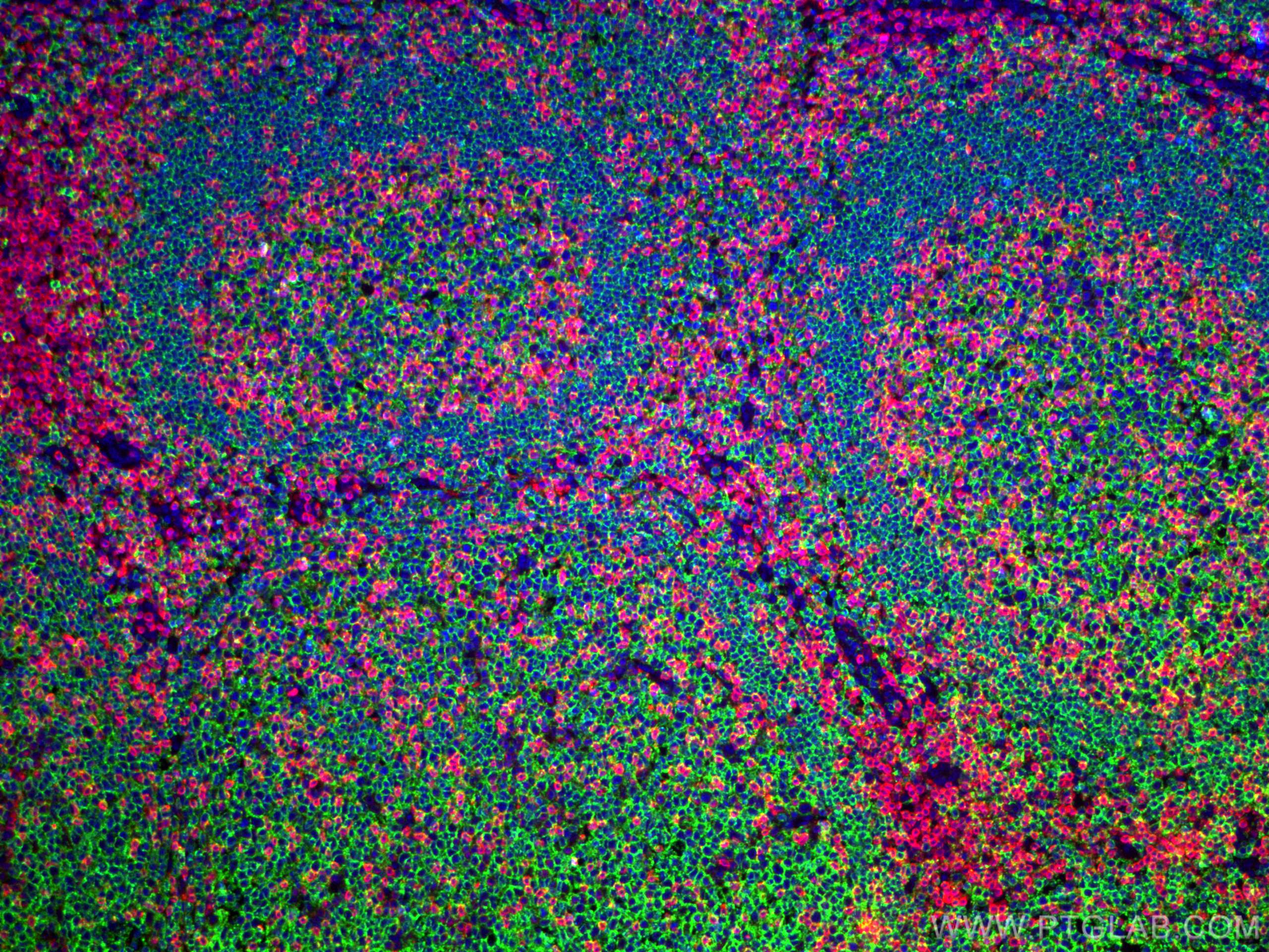 Immunofluorescence (IF) / fluorescent staining of human tonsillitis tissue using CD3 Monoclonal antibody (60181-1-Ig)