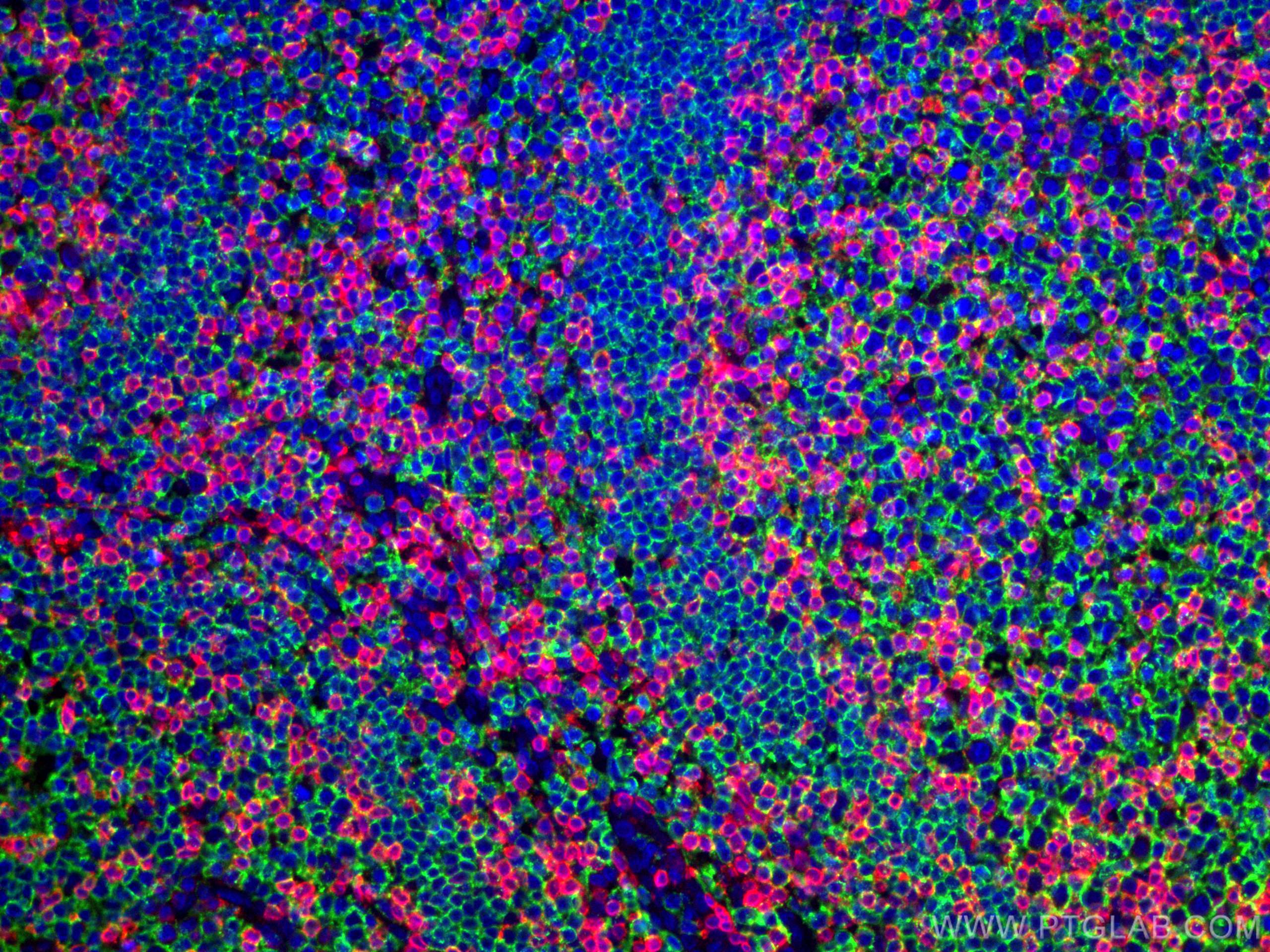 Immunofluorescence (IF) / fluorescent staining of human tonsillitis tissue using CD3 Monoclonal antibody (60181-1-Ig)