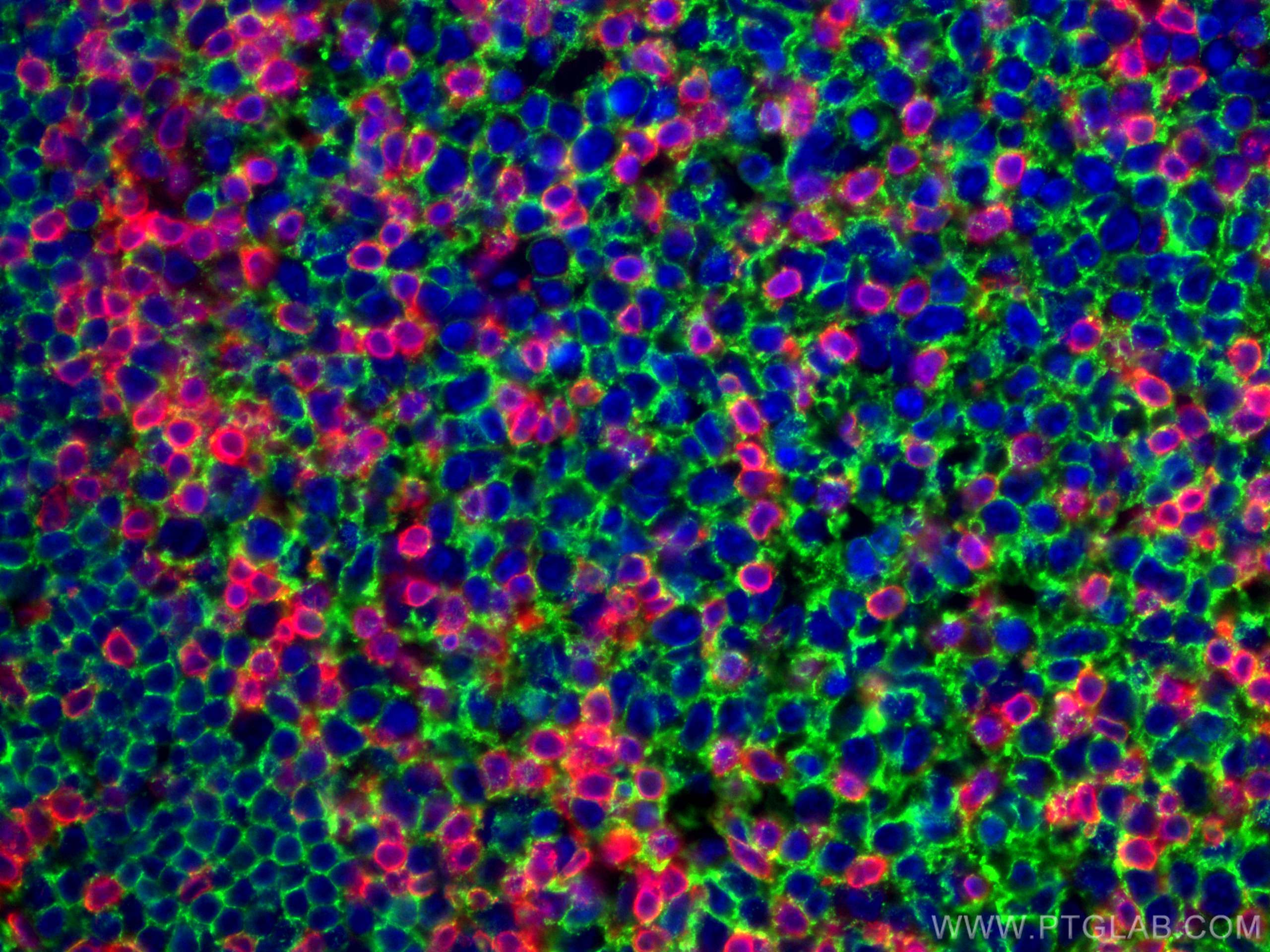 Immunofluorescence (IF) / fluorescent staining of human tonsillitis tissue using CD3 Monoclonal antibody (60181-1-Ig)