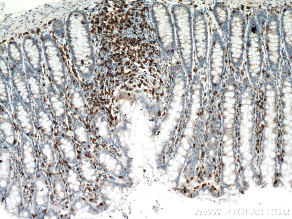 Immunohistochemistry (IHC) staining of human colon tissue using CD3 Monoclonal antibody (60181-1-Ig)