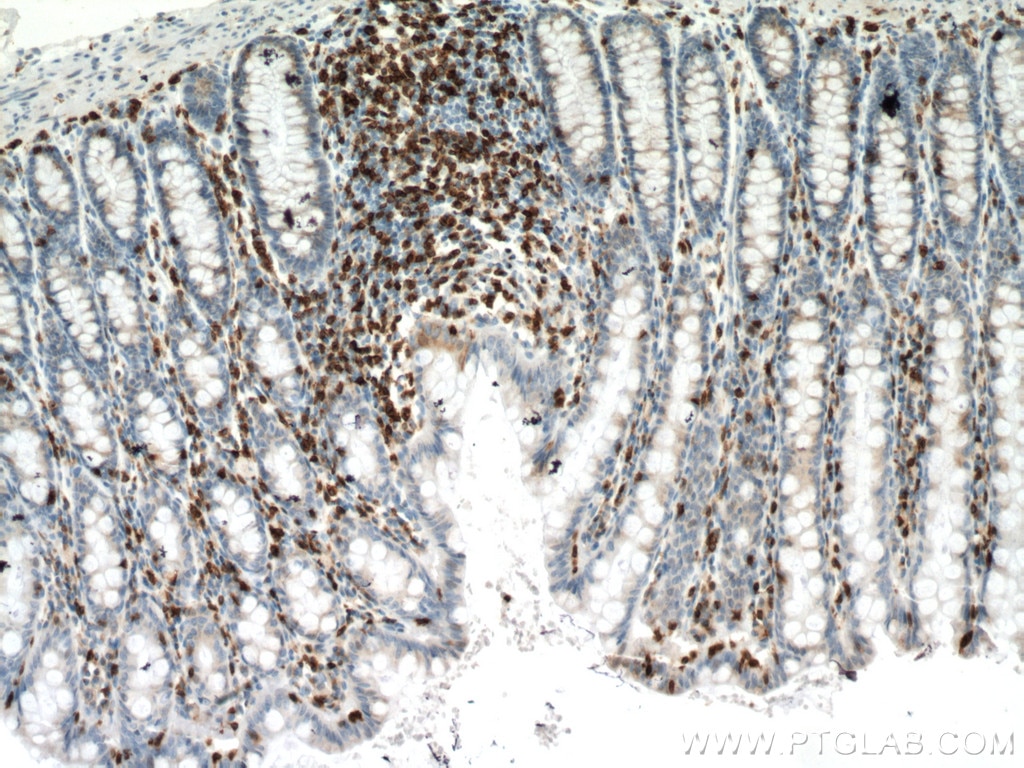 IHC staining of human colon using 60181-1-Ig