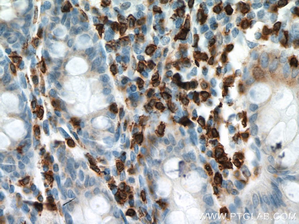 Immunohistochemistry (IHC) staining of human colon tissue using CD3 Monoclonal antibody (60181-1-Ig)