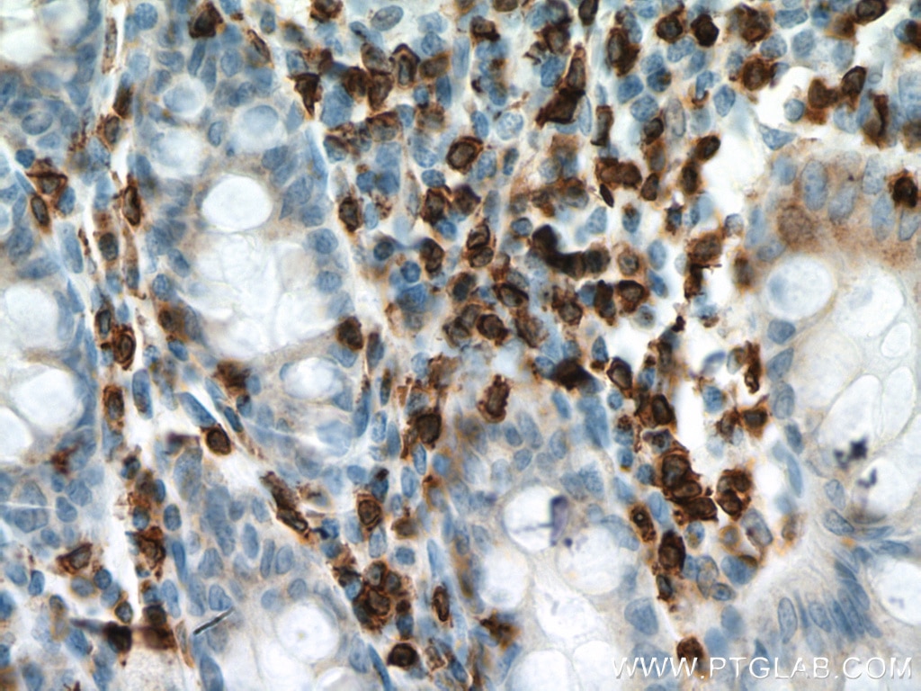 IHC staining of human colon using 60181-1-Ig