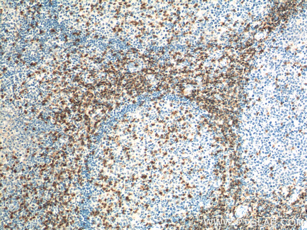 CD3 Monoclonal antibody