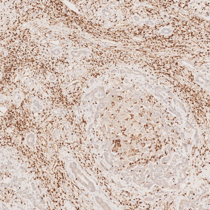 IHC staining of human liver using 60181-1-Ig Immunohistochemistry (IHC) staining of human liver tissue using CD3 Monoclonal antibody (60181-1-Ig)