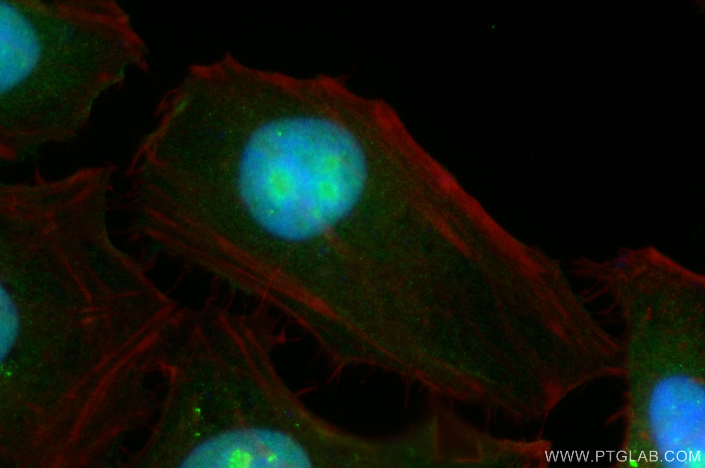 Immunofluorescence (IF) / fluorescent staining of HeLa cells using CD3EAP Polyclonal antibody (31014-1-AP)