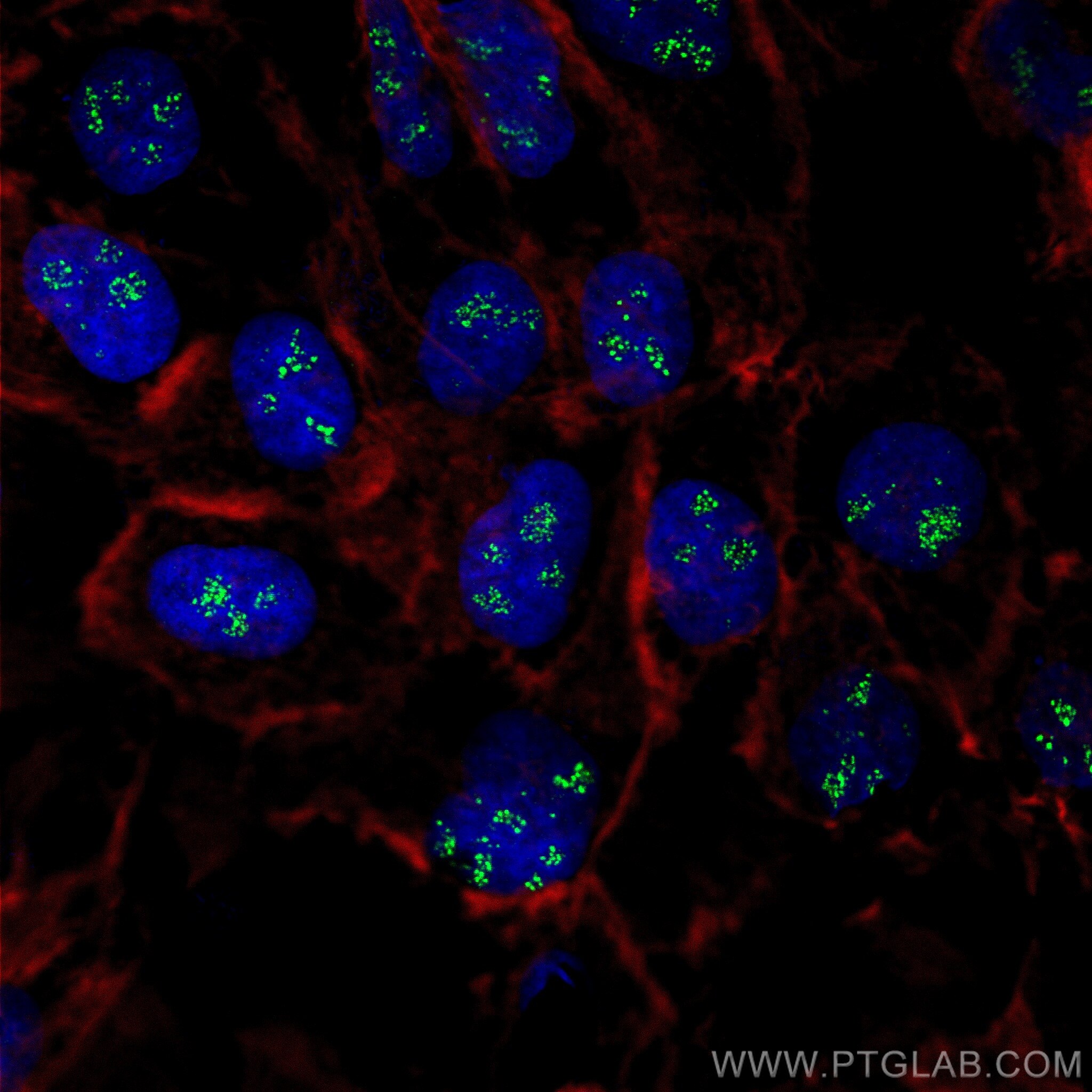 Immunofluorescence (IF) / fluorescent staining of A431 cells using CD3EAP Polyclonal antibody (31162-1-AP)