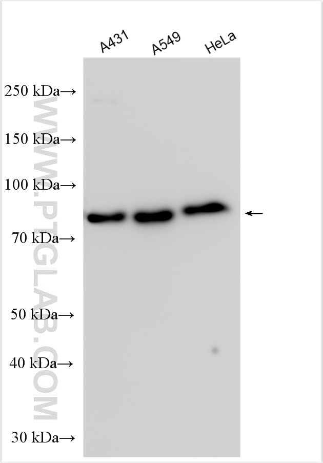 Western Blot (WB) analysis of various lysates using CD3EAP Polyclonal antibody (31162-1-AP)