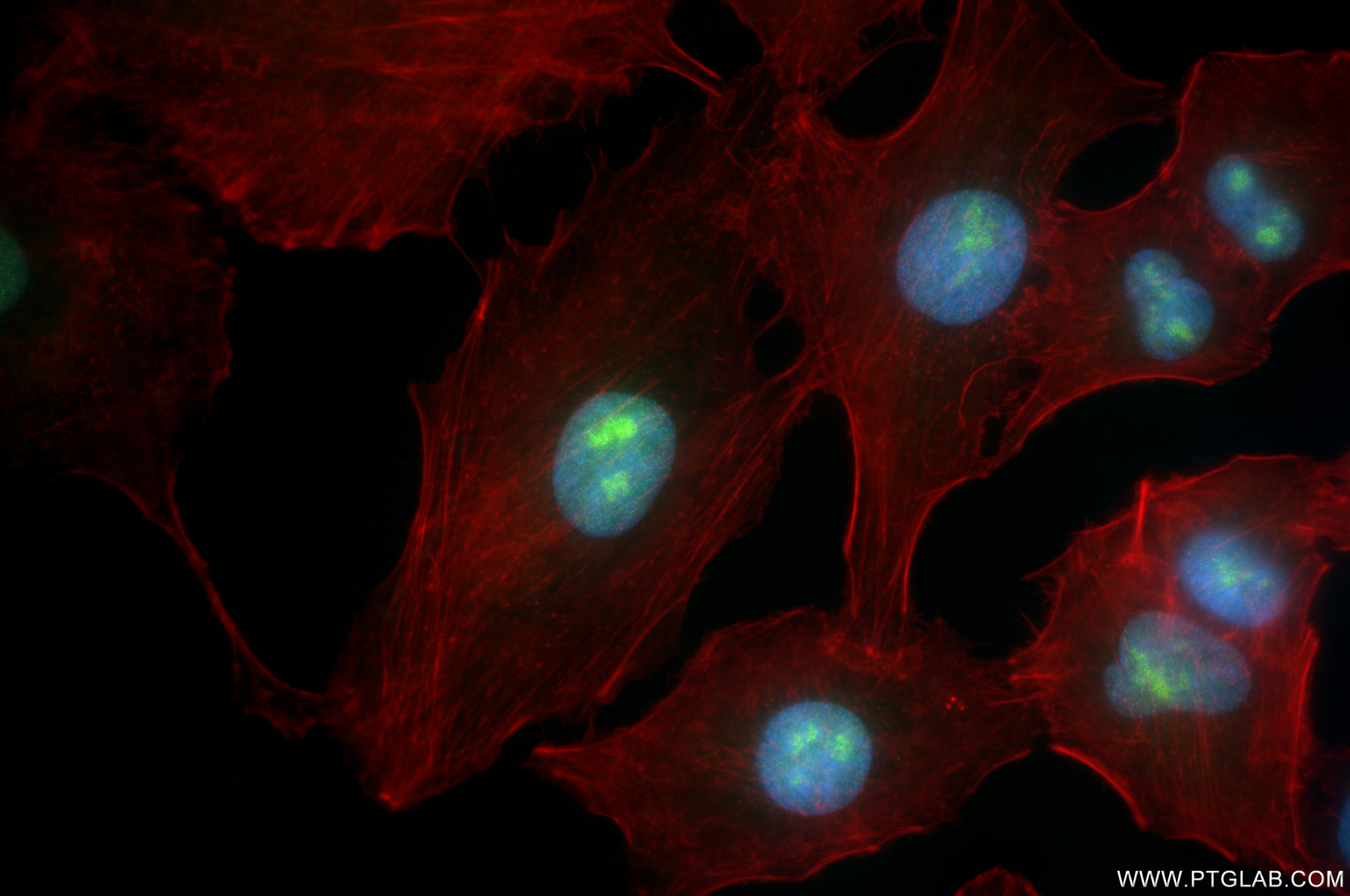 Immunofluorescence (IF) / fluorescent staining of A549 cells using CD3EAP Recombinant antibody (84139-4-RR)