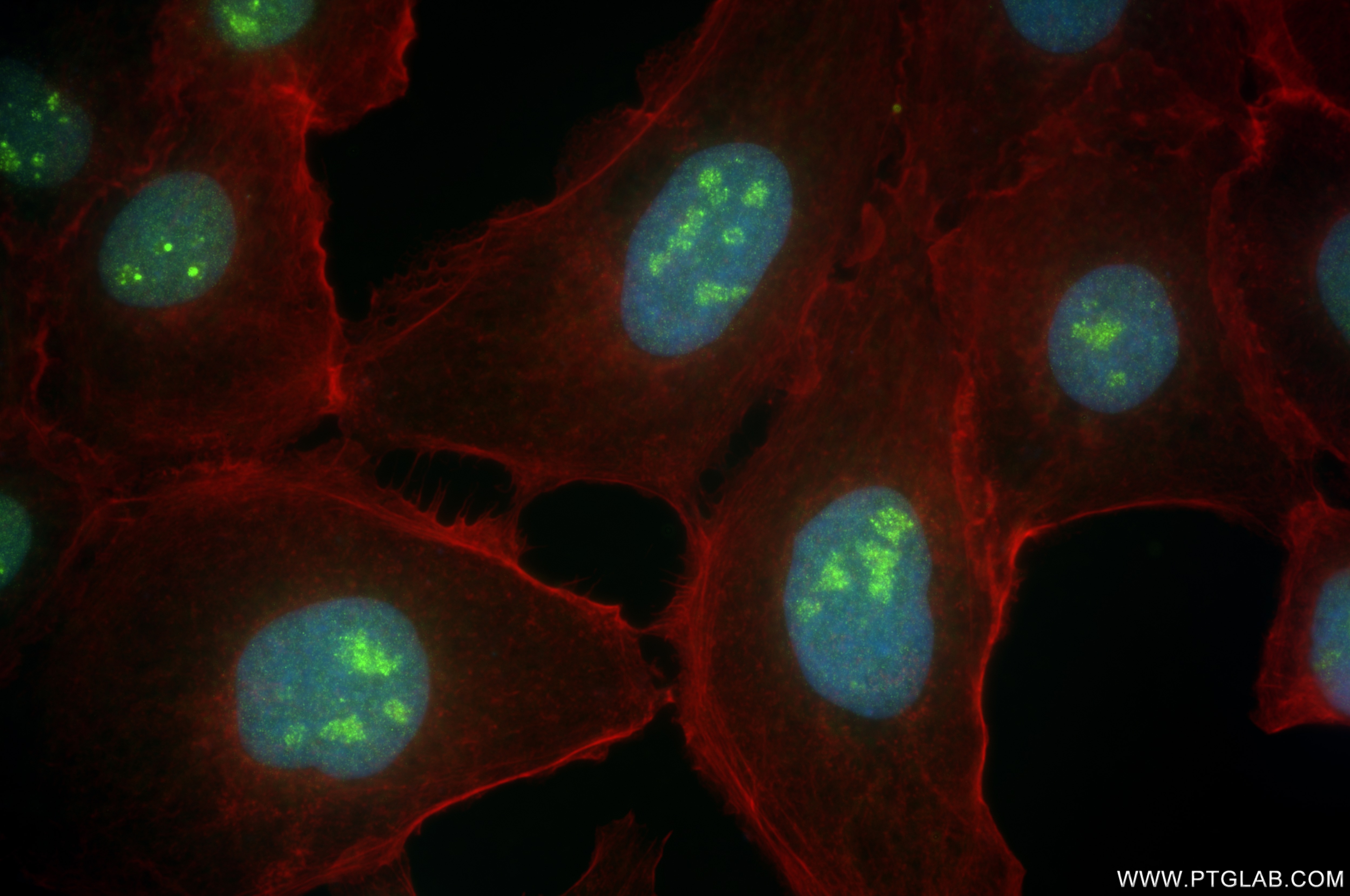Immunofluorescence (IF) / fluorescent staining of A431 cells using CD3EAP Recombinant antibody (84139-4-RR)