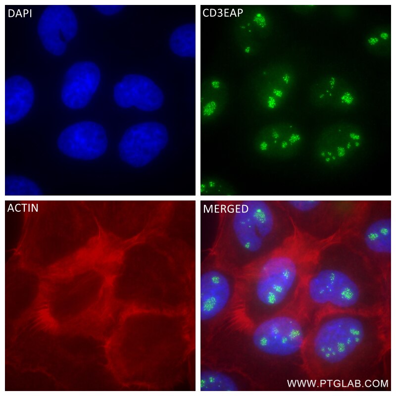 Immunofluorescence (IF) / fluorescent staining of A431 cells using CD3EAP Recombinant antibody (84139-5-RR)