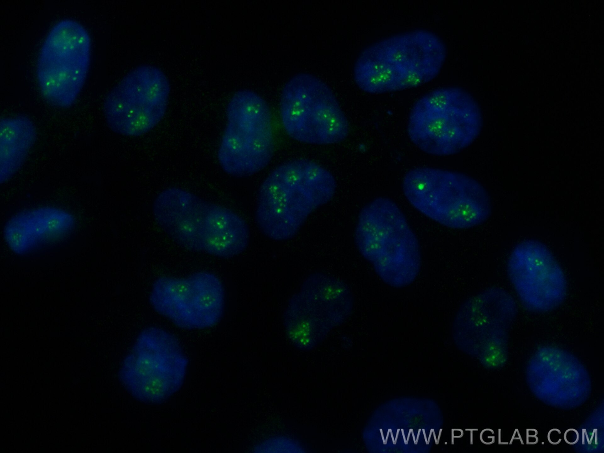 Immunofluorescence (IF) / fluorescent staining of A431 cells using CoraLite® Plus 488-conjugated CD3EAP Recombinant a (CL488-84139-5)